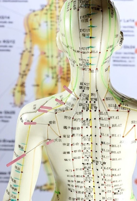 Acupuncture Plymouth | Acupuncture for Injury Plymouth | Acupuncturist Plymouth